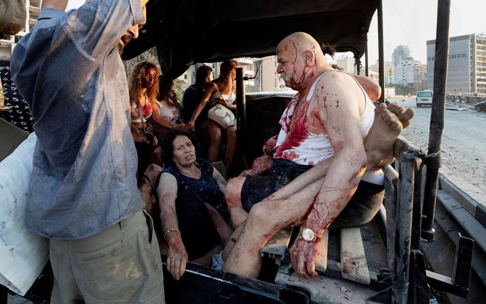 Brutale bilder fra Beirut med blodige  klær på mennesker